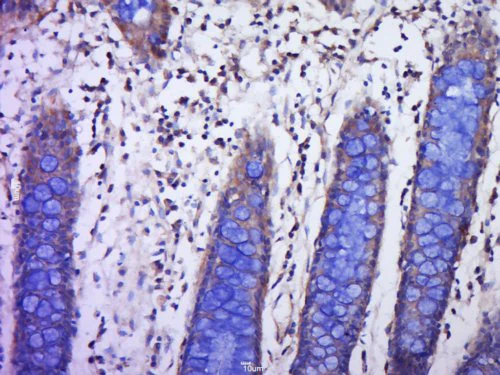 Immunohistochemistry (Formalin/PFA-fixed paraffin-embedded sections) - Anti-PLGF antibody (AB217001)