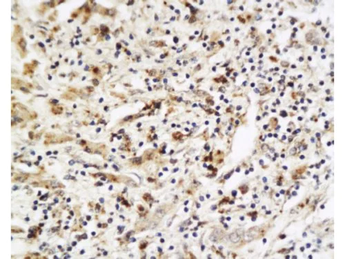 Immunohistochemistry (Formalin/PFA-fixed paraffin-embedded sections) - Anti-PLGF antibody (AB217001)
