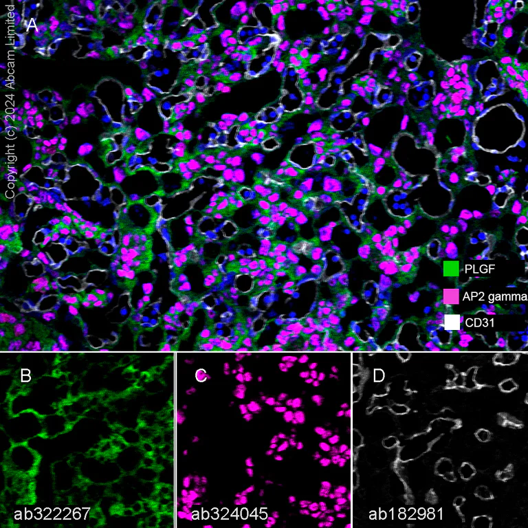 Multiplex immunohistochemistry - Anti-PLGF antibody [EPR29637-148] (AB322267)