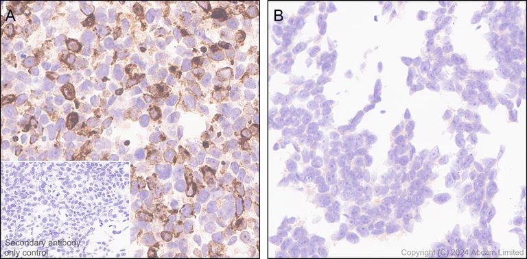 Immunohistochemistry (Formalin/PFA-fixed paraffin-embedded sections) - Anti-PLGF antibody [EPR29637-148] - BSA and Azide free (AB324799)