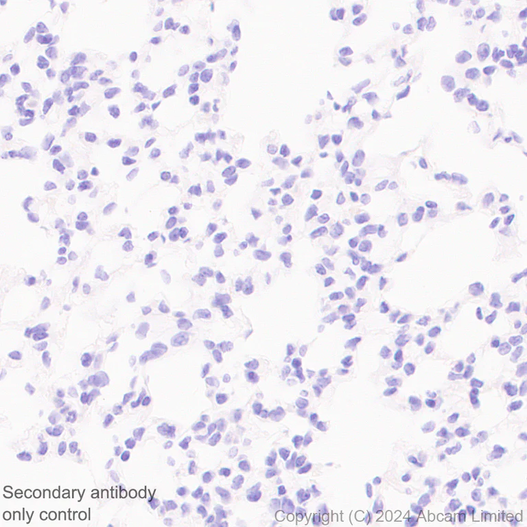 Immunohistochemistry (Formalin/PFA-fixed paraffin-embedded sections) - Anti-PLGF antibody [EPR29637-148] - BSA and Azide free (AB324799)