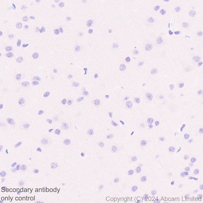 Immunohistochemistry (Formalin/PFA-fixed paraffin-embedded sections) - Anti-PLGF antibody [EPR29637-148] - BSA and Azide free (AB324799)