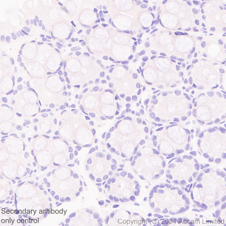 Immunohistochemistry (Formalin/PFA-fixed paraffin-embedded sections) - Anti-PLGF antibody [EPR29637-148] - BSA and Azide free (AB324799)