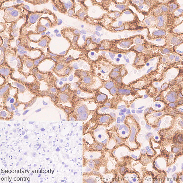 Immunohistochemistry (Formalin/PFA-fixed paraffin-embedded sections) - Anti-PLGF antibody [EPR29637-148] - BSA and Azide free (AB324799)
