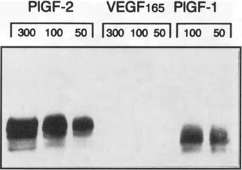 Western blot - Anti-PLGF antibody - N-terminal (AB9542)