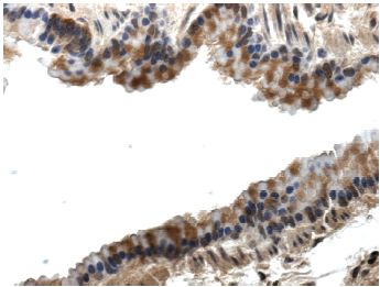 Immunohistochemistry (Formalin/PFA-fixed paraffin-embedded sections) - Anti-PLGF antibody [RM0010-8F09] (AB51654)