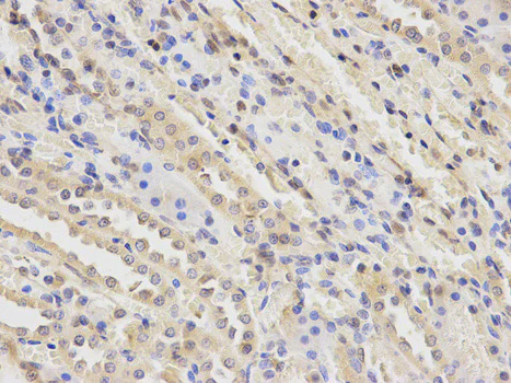Immunohistochemistry (Formalin/PFA-fixed paraffin-embedded sections) - Anti-PLGF1 antibody (AB180734)