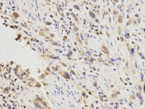 Immunohistochemistry (Formalin/PFA-fixed paraffin-embedded sections) - Anti-PLGF1 antibody (AB180734), expandable thumbnail