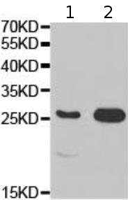 Western blot - Anti-PLGF1 antibody (AB180734), expandable thumbnail