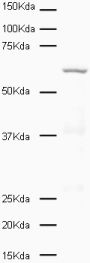 Western blot - Anti-PLK1 antibody [36-298] (ab17057), expandable thumbnail