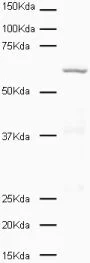 Western blot - Anti-PLK1 antibody [36-298] (AB17057)