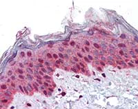 Immunohistochemistry (Formalin/PFA-fixed paraffin-embedded sections) - Anti-PLK1 antibody (AB109777)