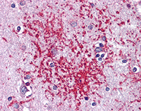 Immunohistochemistry (Formalin/PFA-fixed paraffin-embedded sections) - Anti-PLK1 antibody (AB109777)
