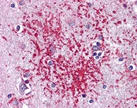 Immunohistochemistry (Formalin/PFA-fixed paraffin-embedded sections) - Anti-PLK1 antibody (AB109777)