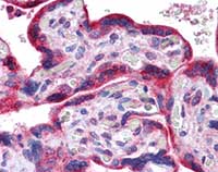 Immunohistochemistry (Formalin/PFA-fixed paraffin-embedded sections) - Anti-PLK1 antibody (AB109777)