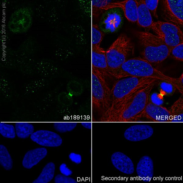 Immunocytochemistry/ Immunofluorescence - Anti-PLK1 antibody [EPR19534] (AB189139), expandable thumbnail