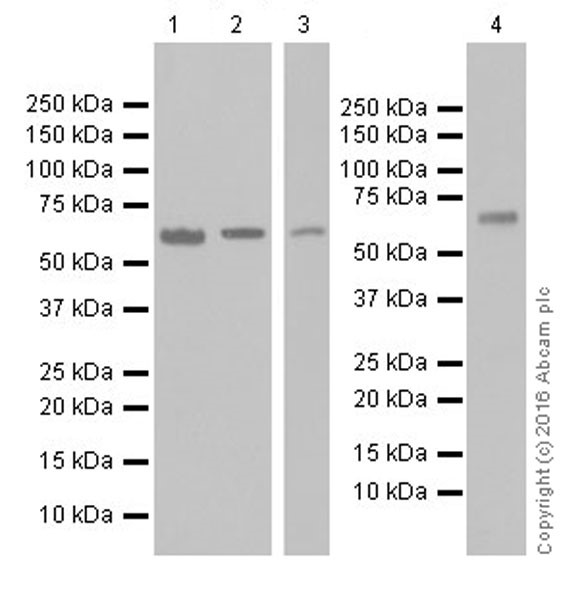 Western blot - Anti-PLK1 antibody [EPR19534] (AB189139), expandable thumbnail