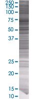 SDS-PAGE - PLK1 overexpression 293T lysate (whole cell) (AB94104), expandable thumbnail