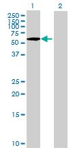 Western blot - PLK1 overexpression 293T lysate (whole cell) (AB94104), expandable thumbnail