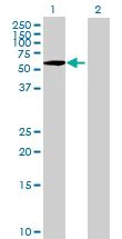 Western blot - PLK1 overexpression 293T lysate (whole cell) (AB94104)