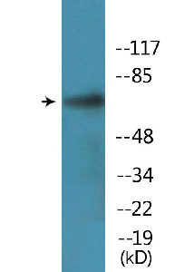 Western blot - Anti-PLK1 (phospho S137) antibody (AB138685), expandable thumbnail