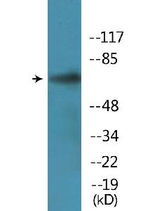 Western blot - Anti-PLK1 (phospho S137) antibody (AB138685)