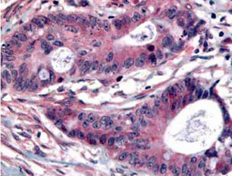 Immunohistochemistry (Formalin/PFA-fixed paraffin-embedded sections) - Anti-PLK1 (phospho T210) antibody (AB12157)