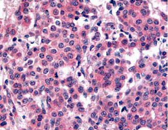 Immunohistochemistry (Formalin/PFA-fixed paraffin-embedded sections) - Anti-PLK1 (phospho T210) antibody (AB12157), expandable thumbnail