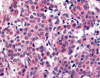 Immunohistochemistry (Formalin/PFA-fixed paraffin-embedded sections) - Anti-PLK1 (phospho T210) antibody (AB12157)