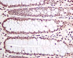 Immunohistochemistry (Formalin/PFA-fixed paraffin-embedded sections) - Anti-PLK1 (phospho T210) antibody [EPNCIR167] (AB155095)