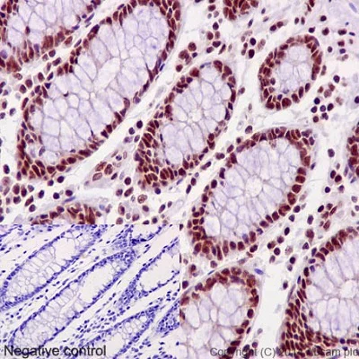 Immunohistochemistry (Formalin/PFA-fixed paraffin-embedded sections) - Anti-PLK1 (phospho T210) antibody [EPNCIR167] (AB155095)