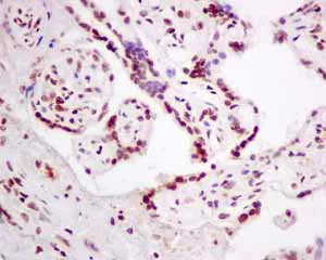 Immunohistochemistry (Formalin/PFA-fixed paraffin-embedded sections) - Anti-PLK1 (phospho T210) antibody [EPNCIR167] (AB155095)