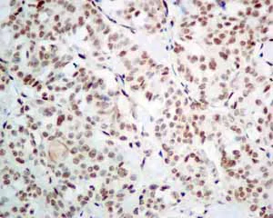 Immunohistochemistry (Formalin/PFA-fixed paraffin-embedded sections) - Anti-PLK1 (phospho T210) antibody [EPNCIR167] (AB155095)