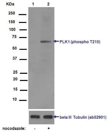 Western blot - Anti-PLK1 (phospho T210) antibody [EPNCIR167] (AB155095)