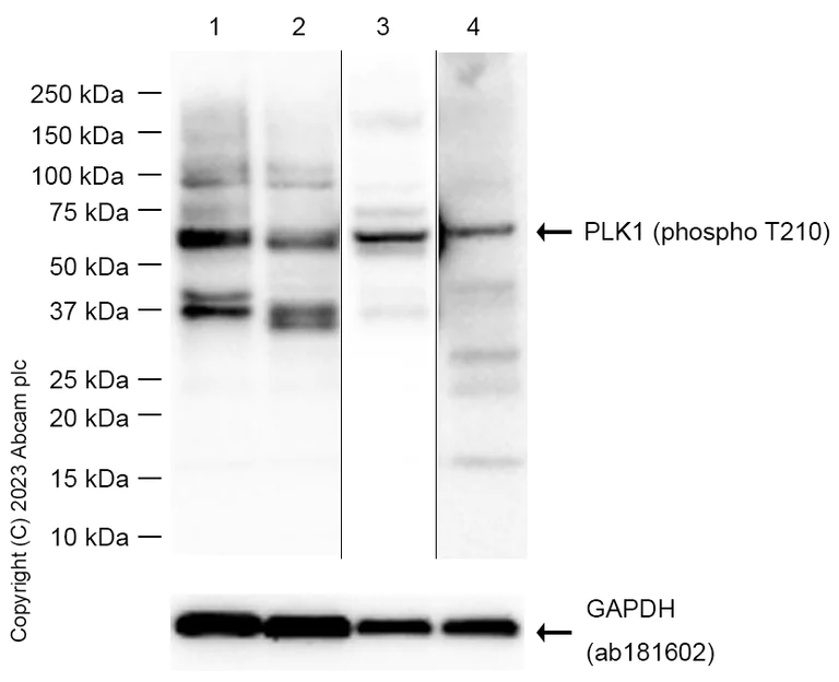 Western blot - Anti-PLK1 (phospho T210) antibody [EPNCIR167] (AB155095)