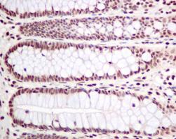 Immunohistochemistry (Formalin/PFA-fixed paraffin-embedded sections) - Anti-PLK1 (phospho T210) antibody [EPNCIR167] - BSA and Azide free (AB240130), expandable thumbnail