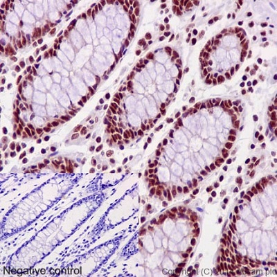 Immunohistochemistry (Formalin/PFA-fixed paraffin-embedded sections) - Anti-PLK1 (phospho T210) antibody [EPNCIR167] - BSA and Azide free (AB240130), expandable thumbnail