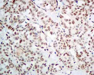 Immunohistochemistry (Formalin/PFA-fixed paraffin-embedded sections) - Anti-PLK1 (phospho T210) antibody [EPNCIR167] - BSA and Azide free (AB240130), expandable thumbnail
