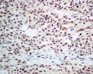 Immunohistochemistry (Formalin/PFA-fixed paraffin-embedded sections) - Anti-PLK1 (phospho T210) antibody [EPNCIR167] - BSA and Azide free (ab240130), expandable thumbnail