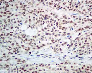 Immunohistochemistry (Formalin/PFA-fixed paraffin-embedded sections) - Anti-PLK1 (phospho T210) antibody [EPNCIR167] - BSA and Azide free (AB240130)