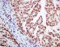 Immunohistochemistry (Formalin/PFA-fixed paraffin-embedded sections) - Anti-PLK1 (phospho T210) antibody [EPNCIR167] - BSA and Azide free (AB240130), expandable thumbnail