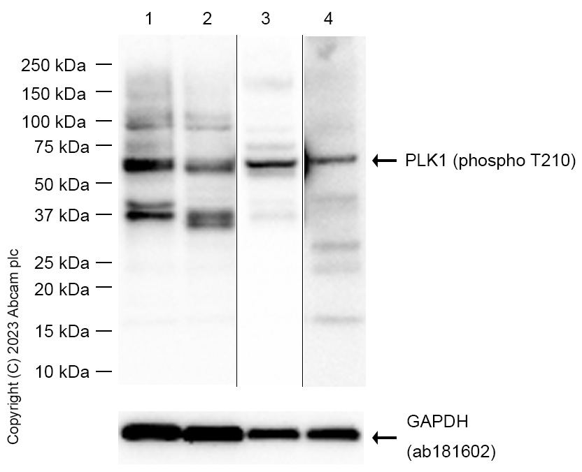 Western blot - Anti-PLK1 (phospho T210) antibody [EPNCIR167] - BSA and Azide free (ab240130), expandable thumbnail