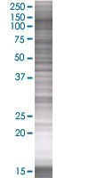 SDS-PAGE - PLK4 overexpression 293T lysate (whole cell) (AB94256)