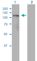 Western blot - PLK4 overexpression 293T lysate (whole cell) (AB94256), expandable thumbnail
