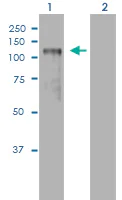 Western blot - PLK4 overexpression 293T lysate (whole cell) (AB94256)
