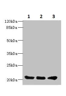 Western blot - Anti-PLLP antibody (AB236668)