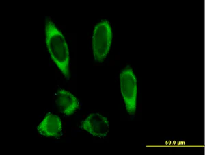 Immunocytochemistry/ Immunofluorescence - Anti-PLOD2/LH2 antibody (AB72939)