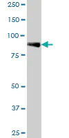 Western blot - Anti-PLOD2/LH2 antibody (AB72939)