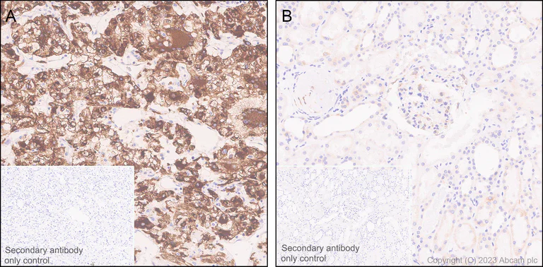 Immunohistochemistry (Formalin/PFA-fixed paraffin-embedded sections) - Anti-PLOD2/LH2 antibody [EPR25160-20] (AB313765)