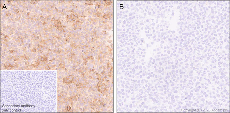 Immunohistochemistry (Formalin/PFA-fixed paraffin-embedded sections) - Anti-PLOD2/LH2 antibody [EPR25160-20] (AB313765)